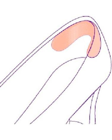 BUBBLE BOBBLE SALVAMEDIAS ADHESIVAS GRIS