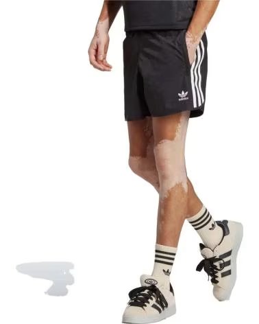 ADIDAS PANTALONCINI 3-STRIPES DA UOMO NEGRO