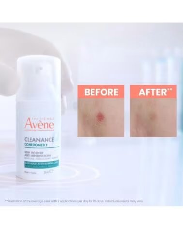 AVENE 